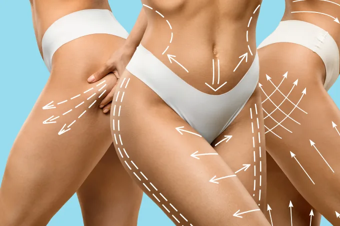Procedimentos Corporais para o Verão em São Paulo | Pró Estética